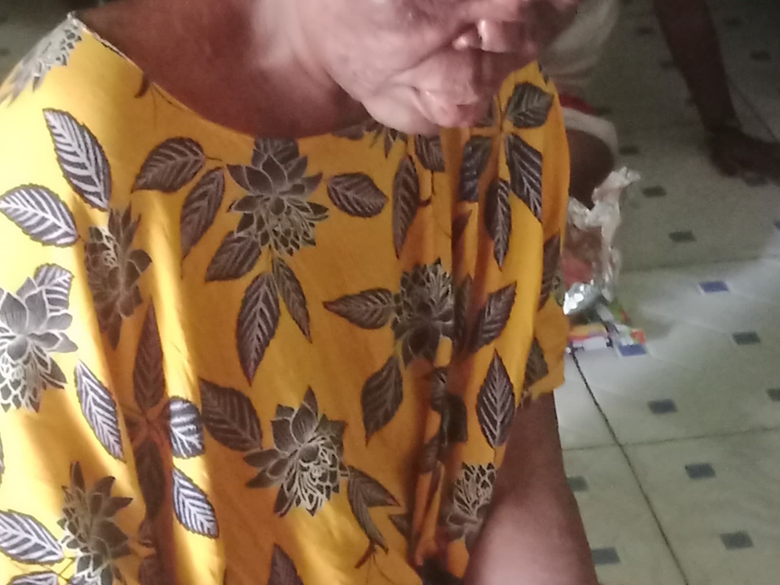 She suffering from skin cancer