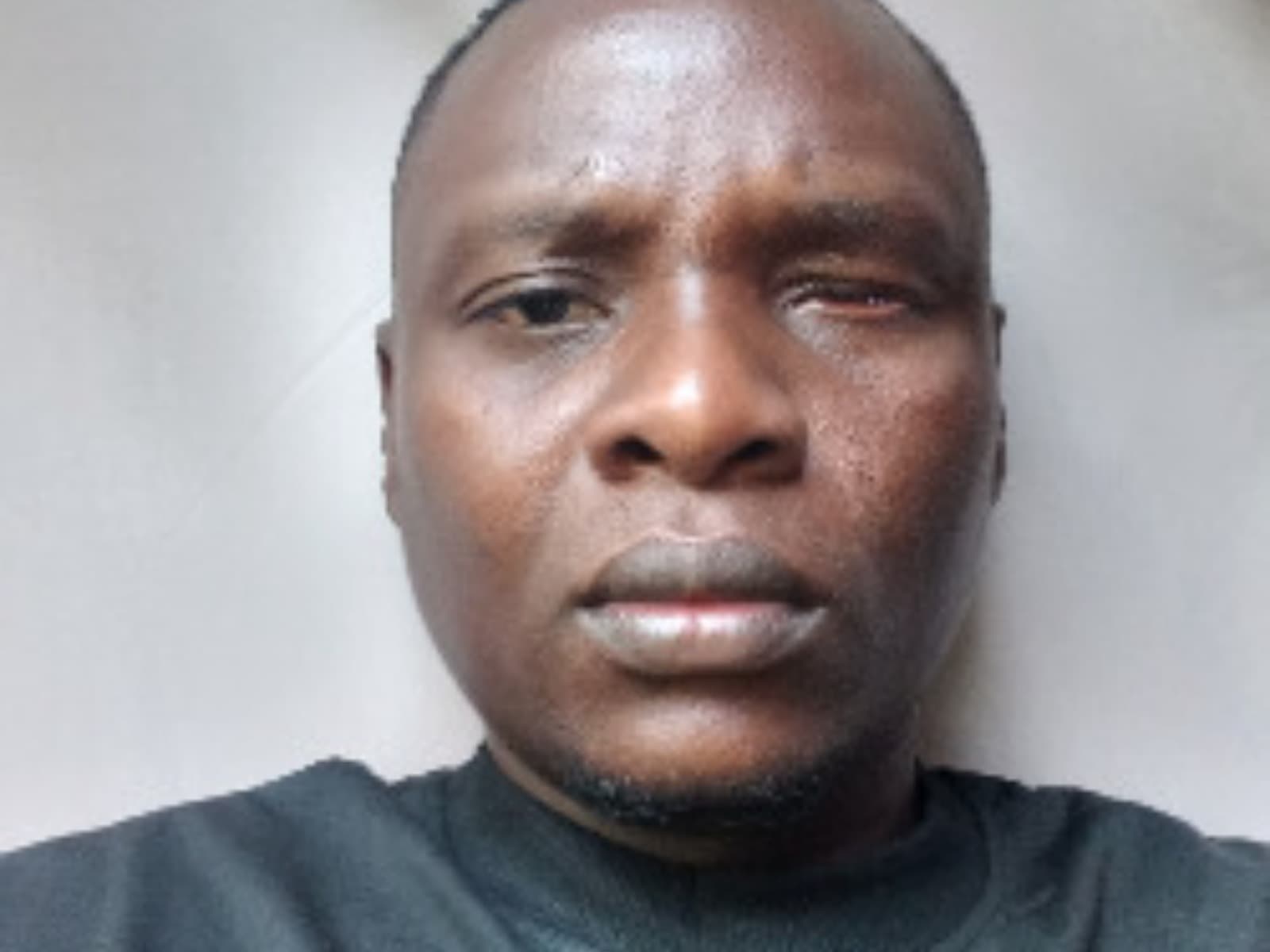 Please help me I need money for eye treatment